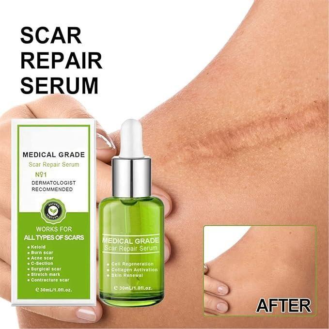 Scar Repair Essence Advanced Scar Gel (30 ml, Pack of 1)